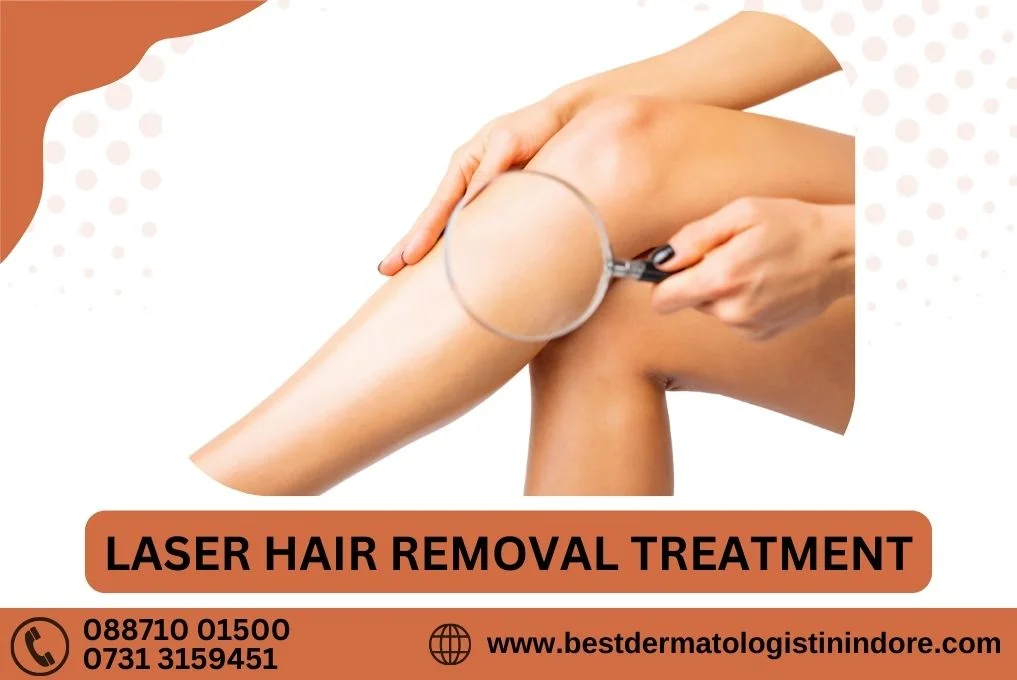 Laser Hair Removal Treatment in Indore