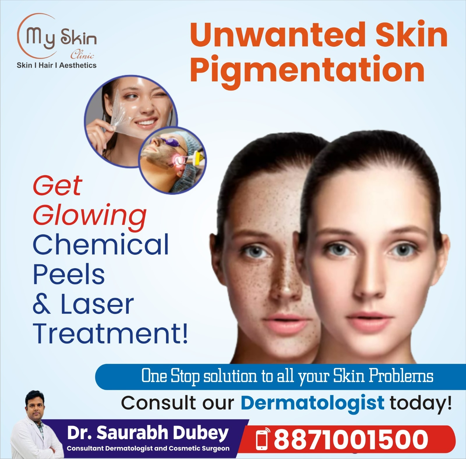 Skin Pigmentation Causes and  Treatments