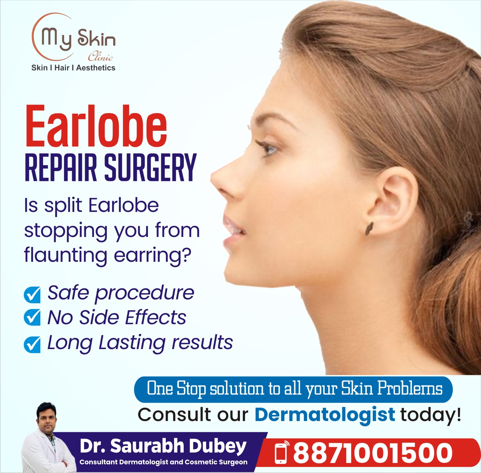 Best Earlobes Repair Surgeon in Indore
