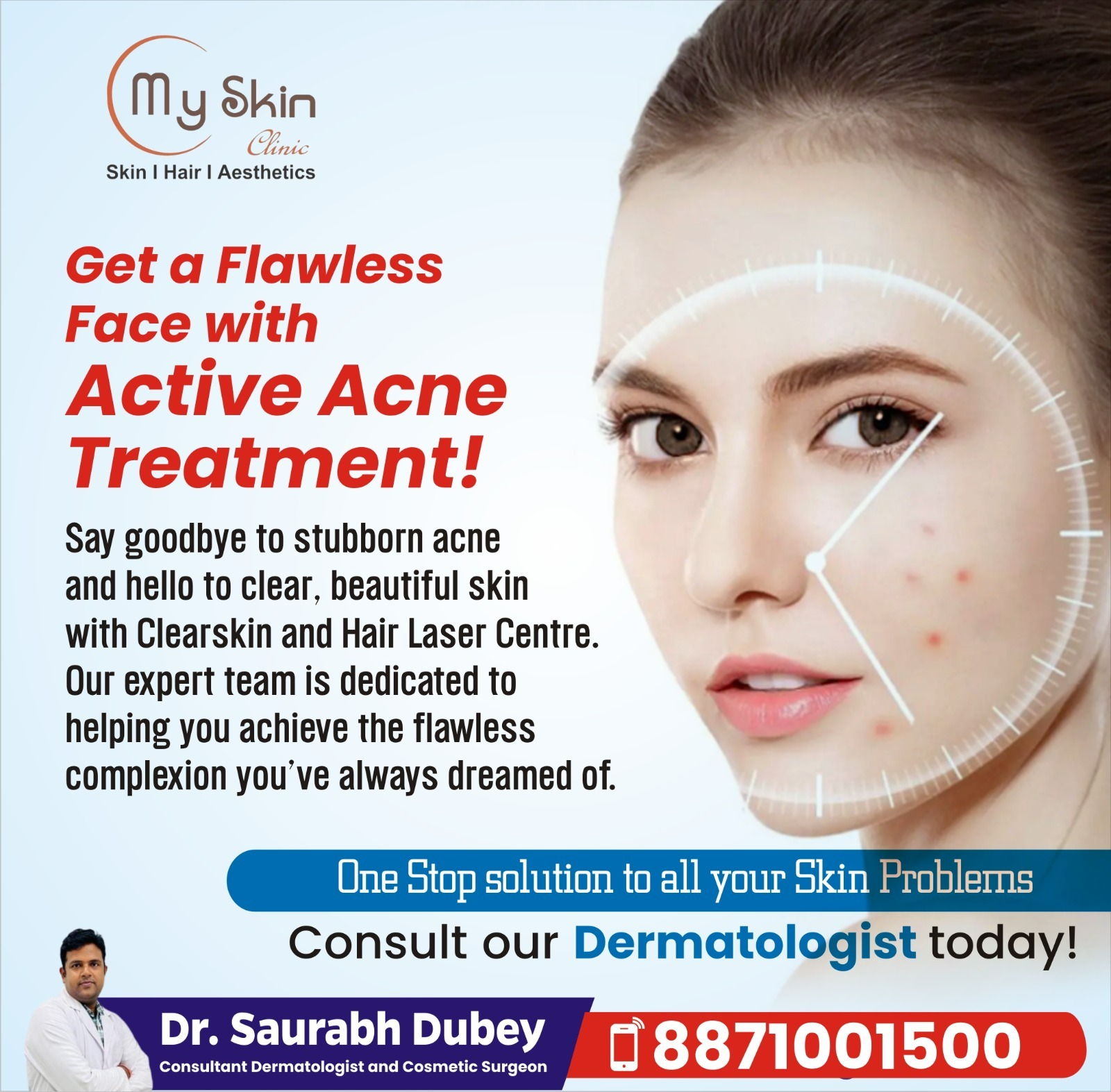 Active Acne Treatment  Specialist In Indore