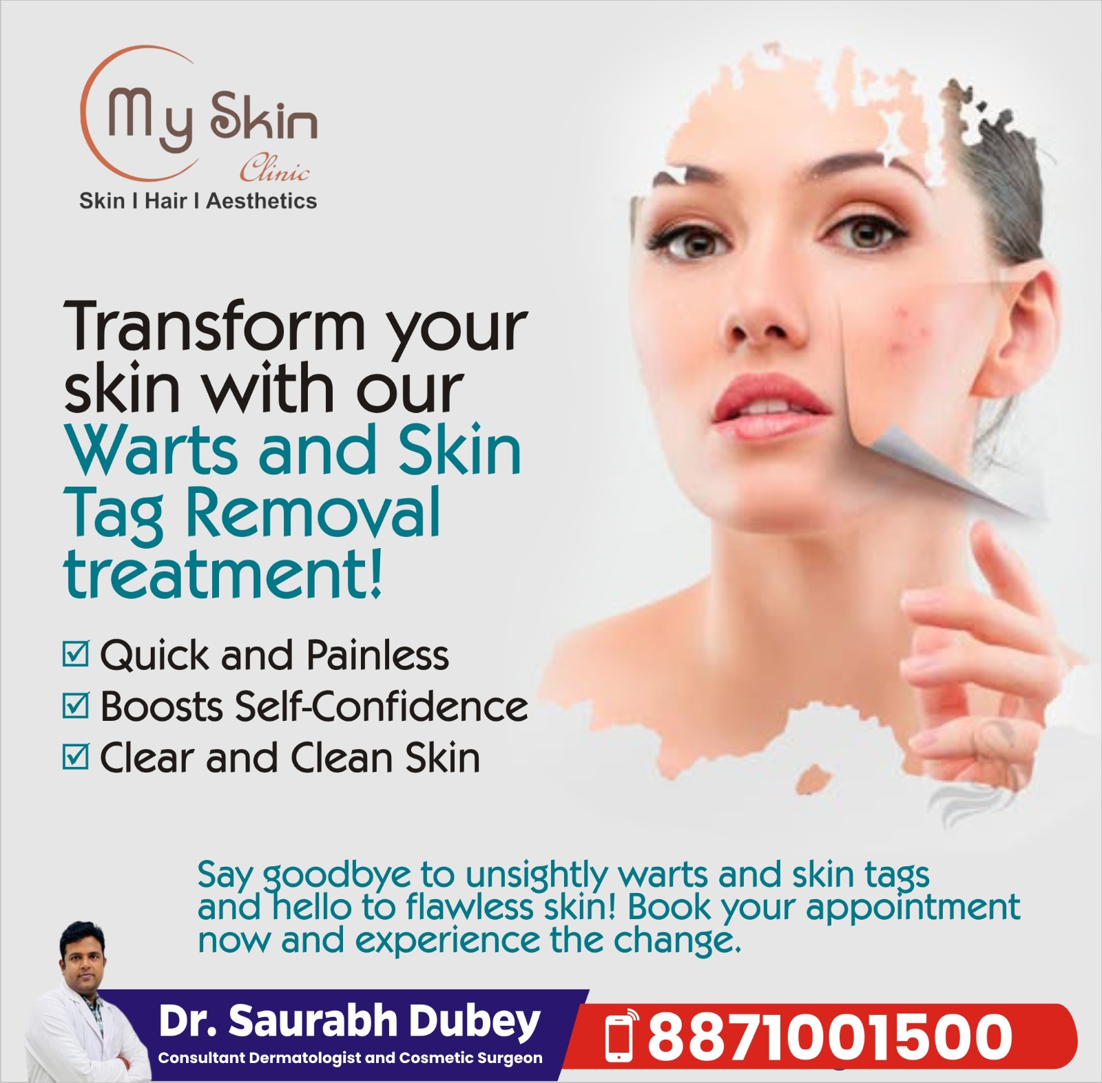 Best Warts And Skin Tags Removal Expert in Indore 