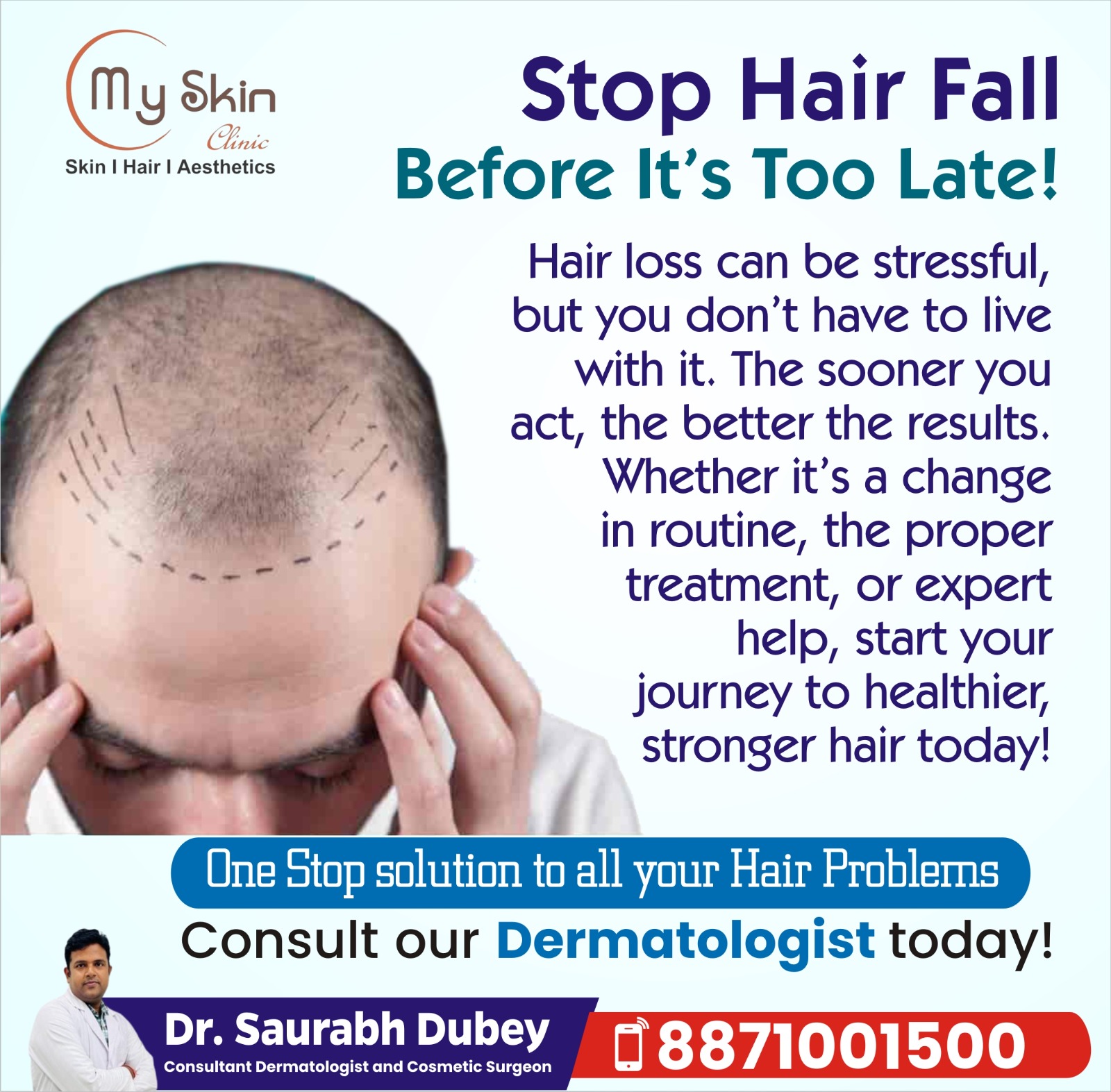 Best Hair Fall Specialist in Indore