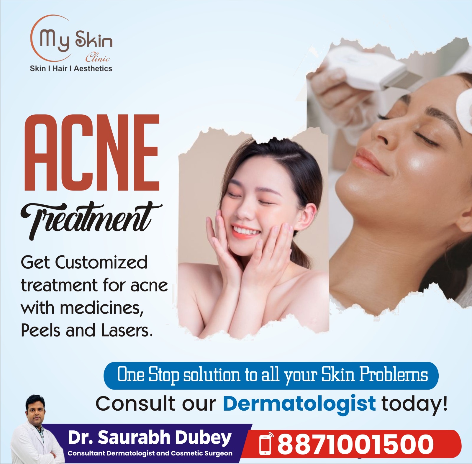 Top Skin Doctor for Acne Treatment in Indore 
