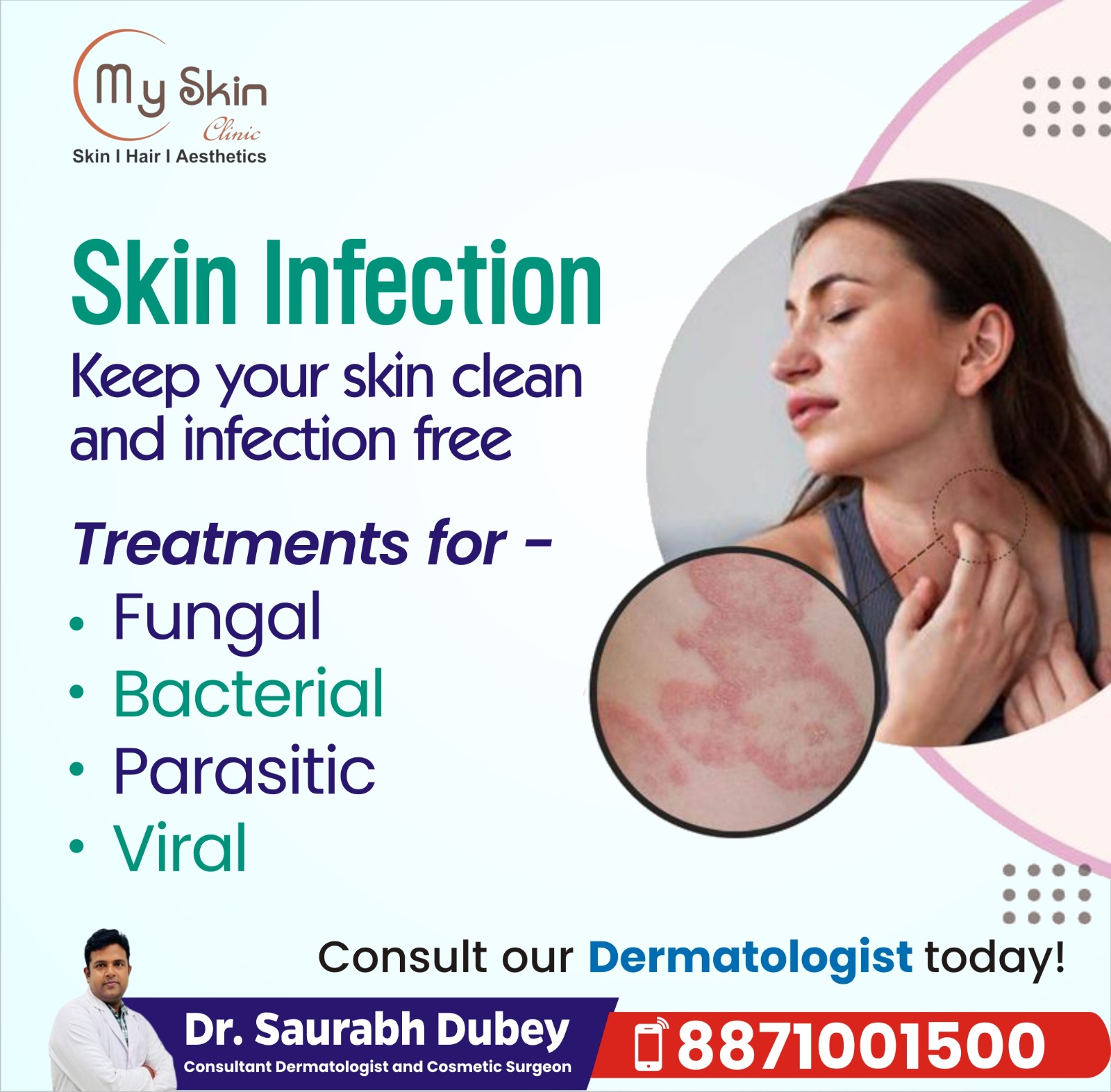 Best Doctor for Skin Infections in Indore 