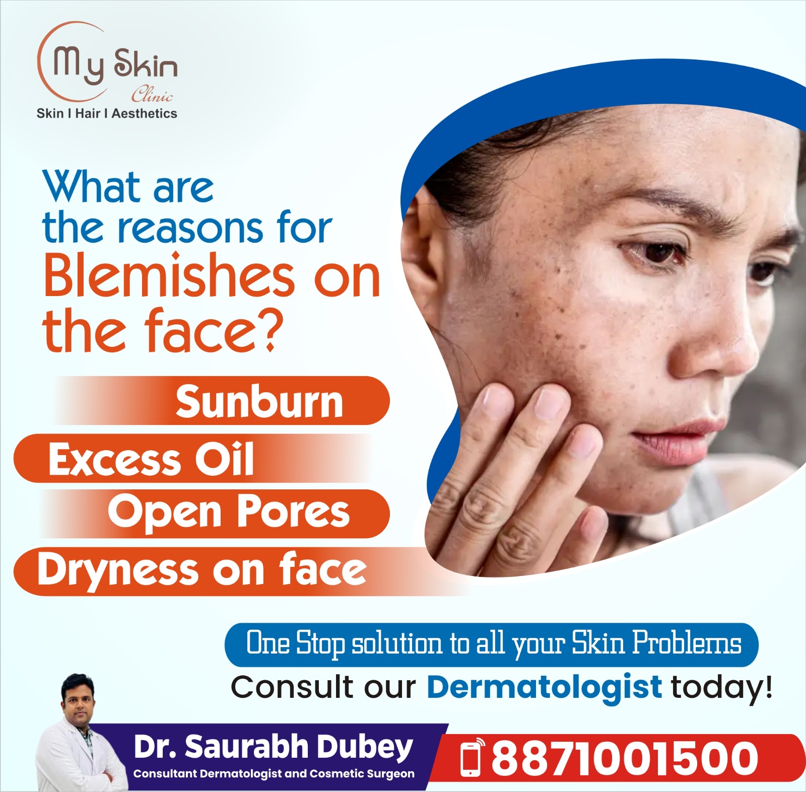 Best Dermatologist in Indore