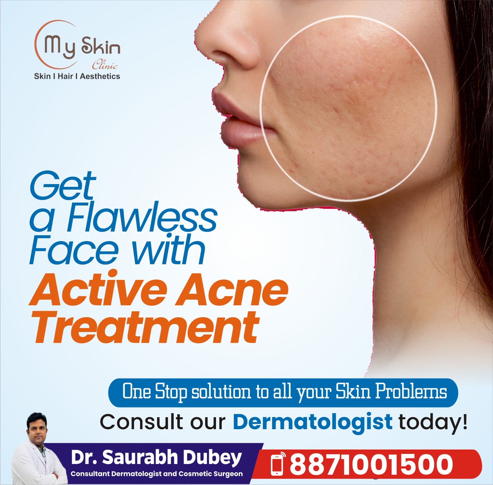 Best Dermatologist in Indore