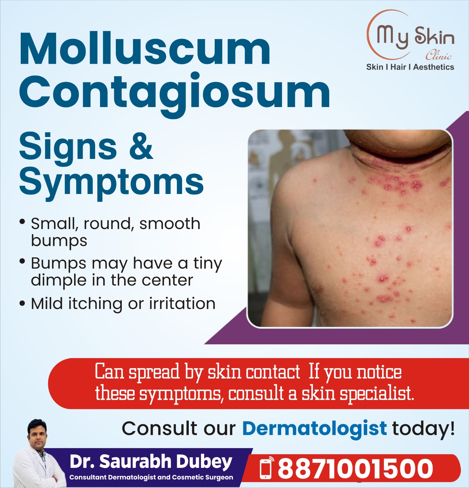 Best Dermatologist in Indore