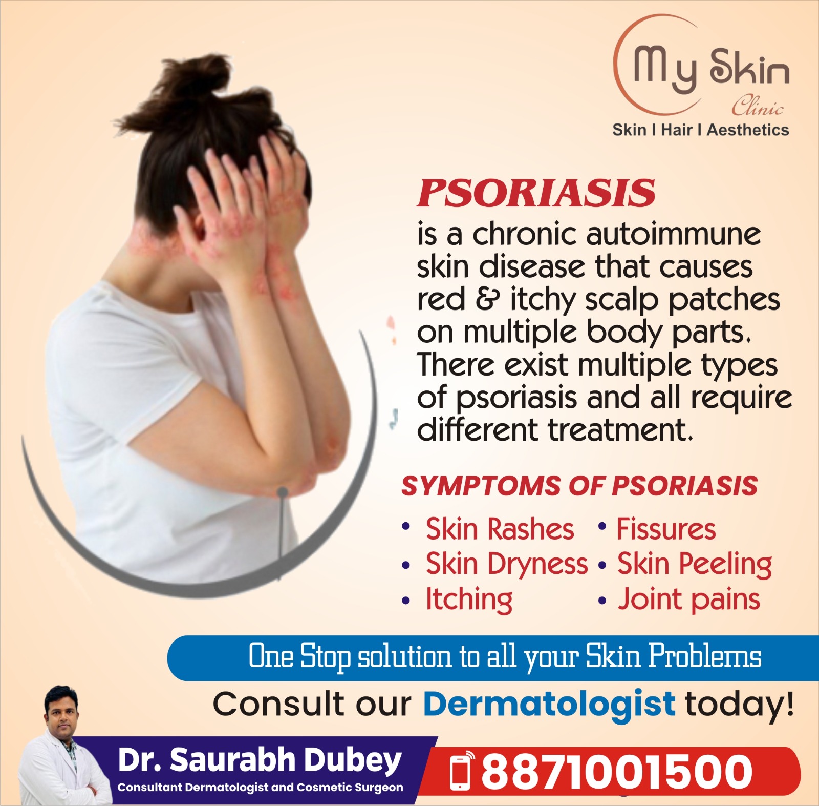 Best Doctor for Psoriasis Treatment in Indore