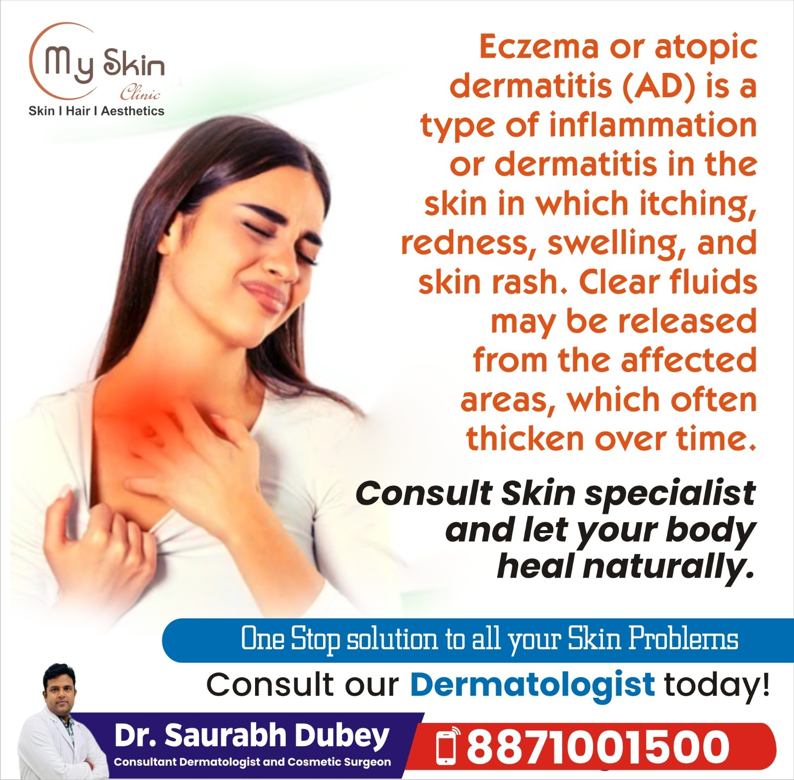 Signs and Symptoms of Eczema