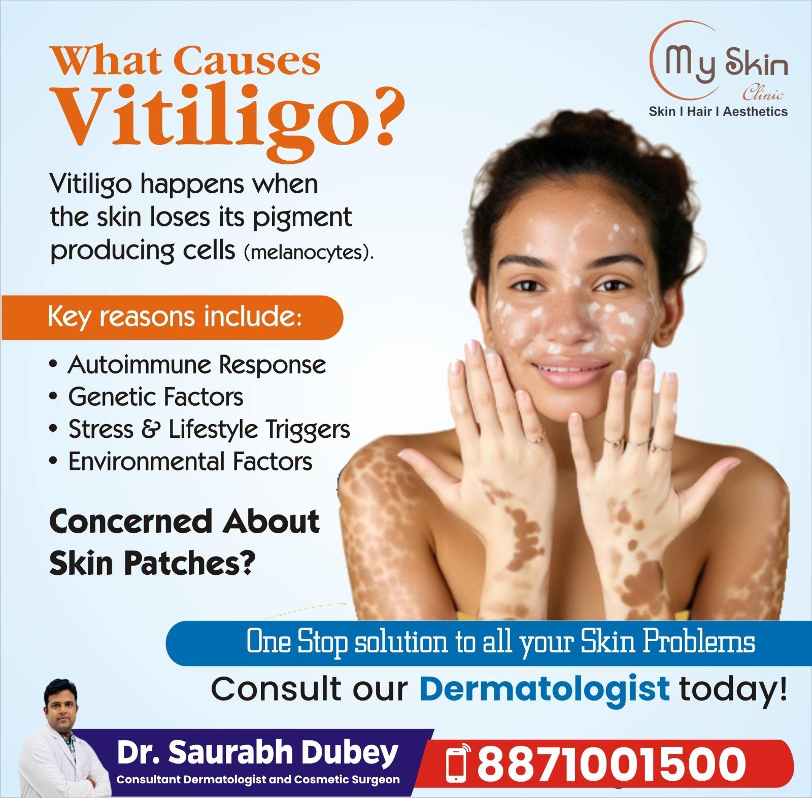 Best Doctors For Vitiligo Treatment In Indore causes and full overview