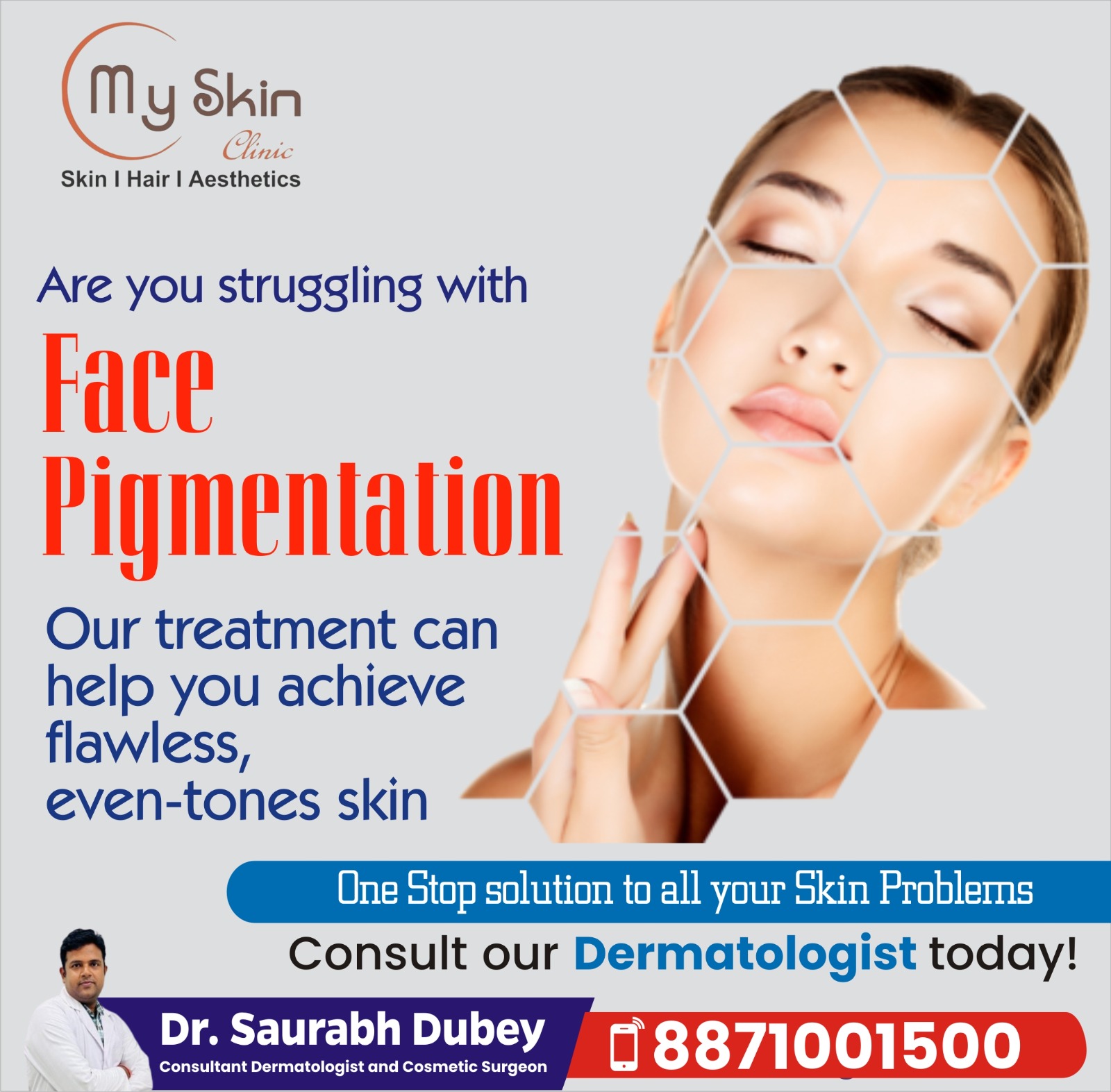 Pigmentation Treatment in Vijay Nagar Indore