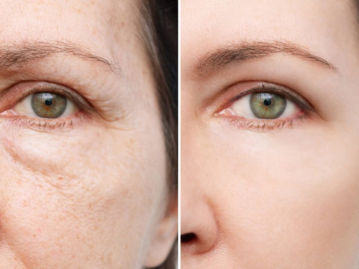 Best Skin Doctor for Pigmentation in Indore