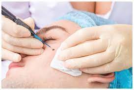 BEST DERMATOLOGY TREATMENT AT AFFORDABLE PRICE IN INDORE