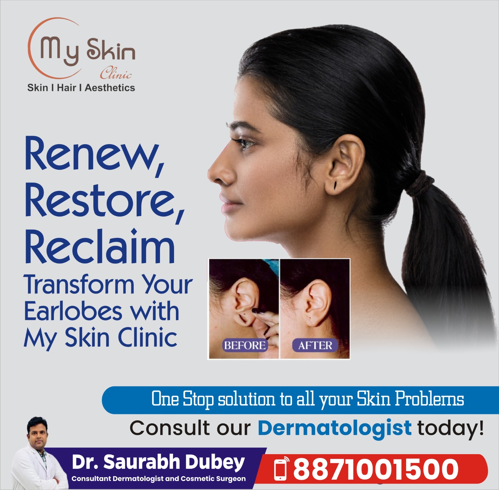 Best Doctor for Earlobes Treatment In Indore