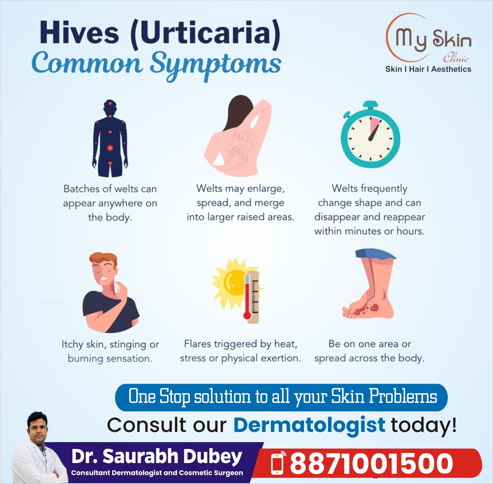 Best Skin Doctor For Hives Treatment In Indore