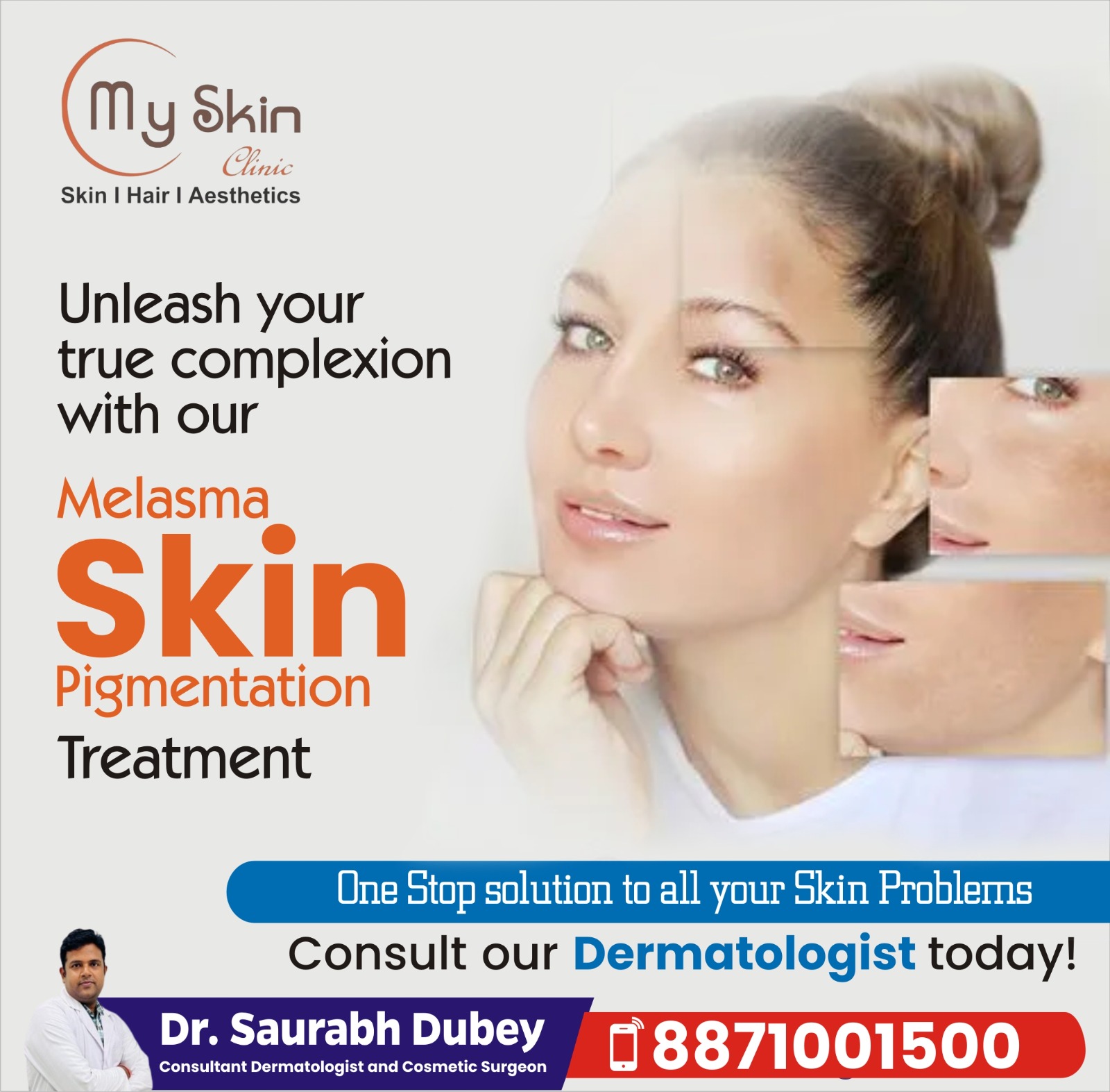 Best Skin Specialist in Vijaynagar Indore