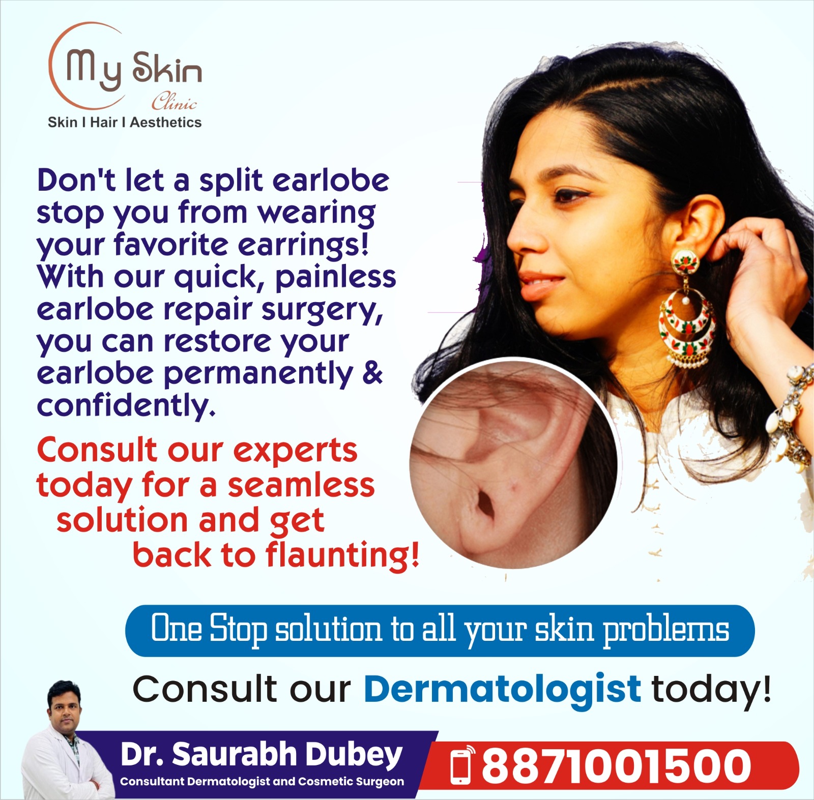Best Doctor for Earlobe in Indore