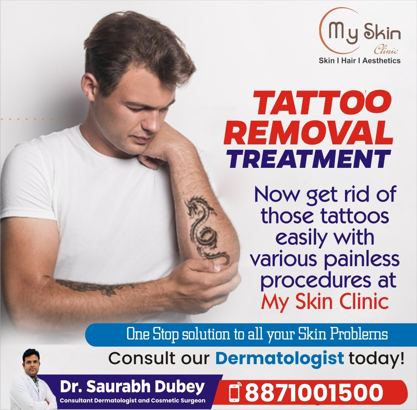 Best Permanent Tattoo Removal Doctor In Indore