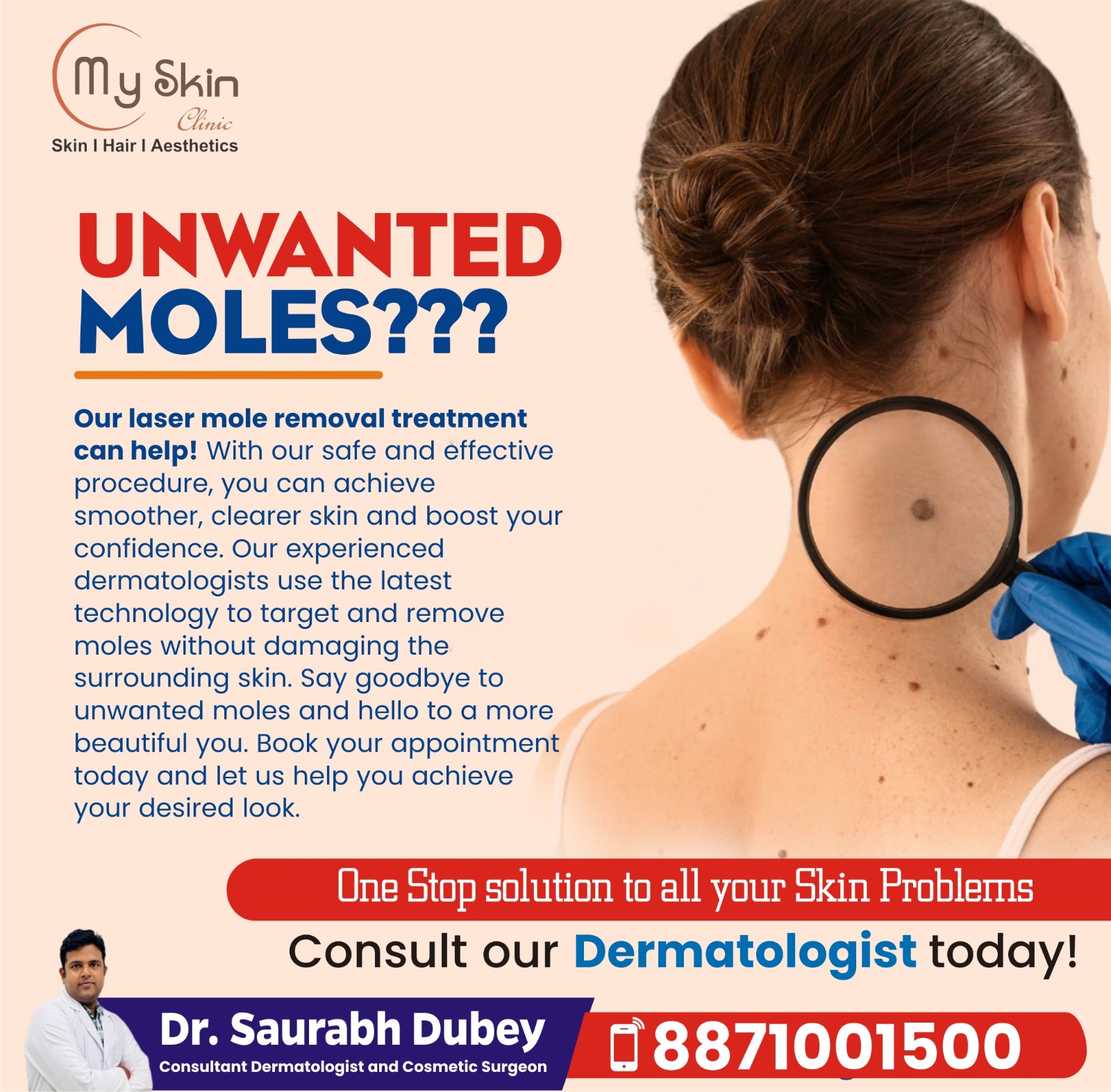 Best Doctor for Mole Removal in Indore