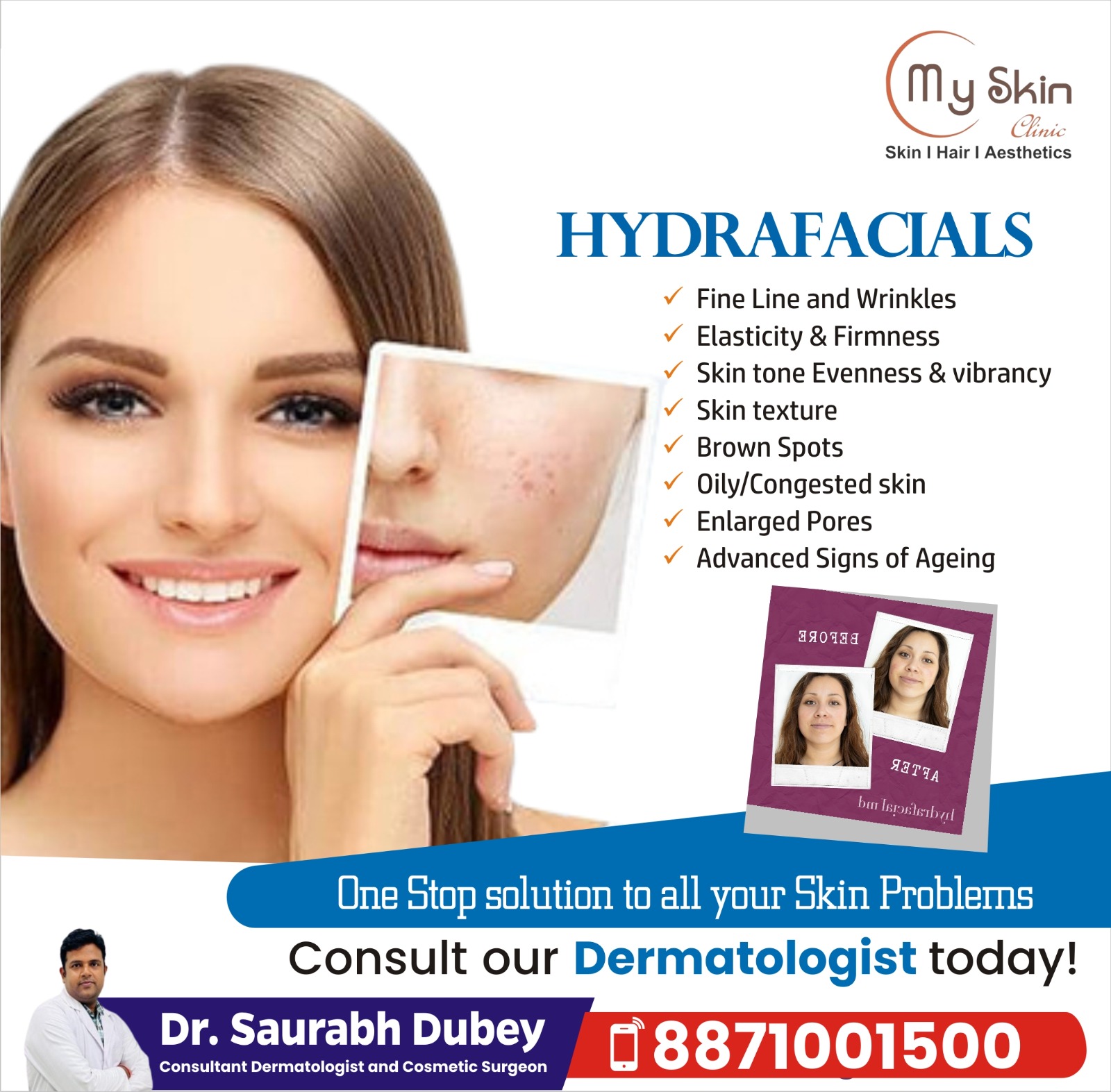 Best Hydra Facial Specialist Indore