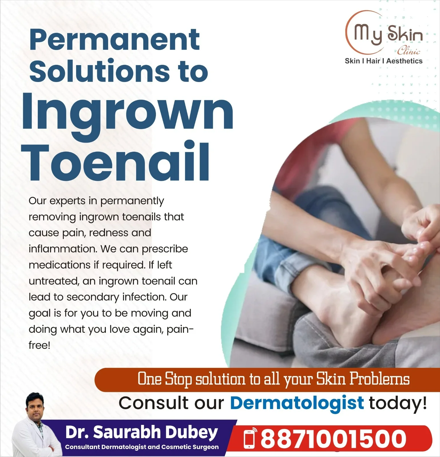 Ingrown Toenail Treatment in Indore